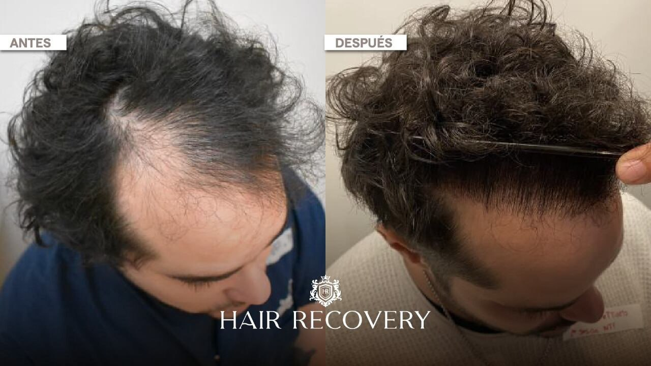 Comparativa capilar antes y después, imagen 6